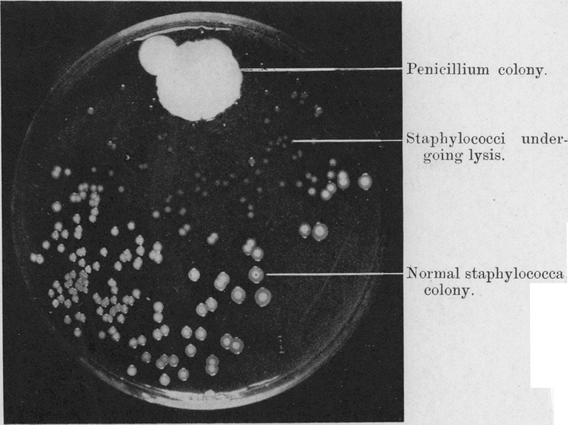 Foto original de Fleming: el hongo Penicillium contra la bacteria Staphylococcus. Gana el hongo por goleada. Fuente.