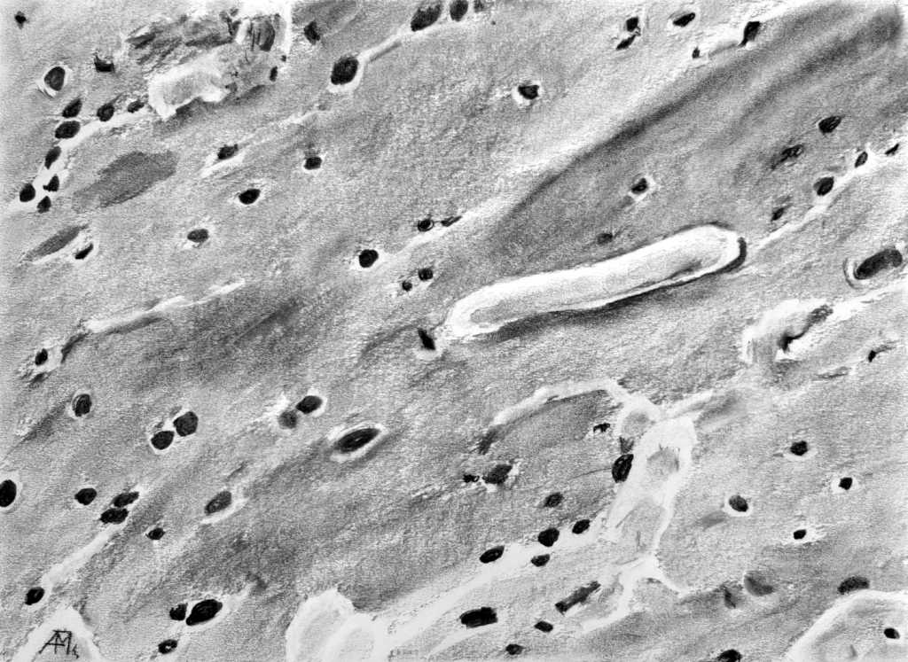 Un ejemplar de Vibrio cholerae, la bacteria que causa el cólera, al microscopio electrónico. Dibujo del autor, basado en esta imagen.