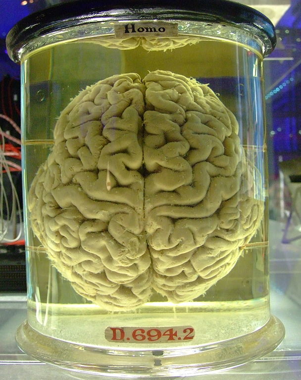 Are we just a brain in a vat? Source: Flick user Gaetan Lee via Wikimedia.